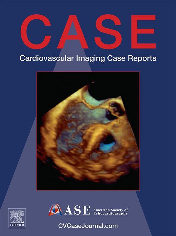 /tapasrevistas/casecardiovascimagreports.jpg