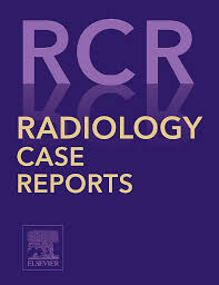 /tapasrevistas/j_radiology_case_reports.jpg